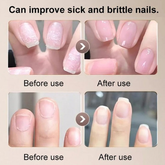 Nagelpflegecreme für gesunde Ngel